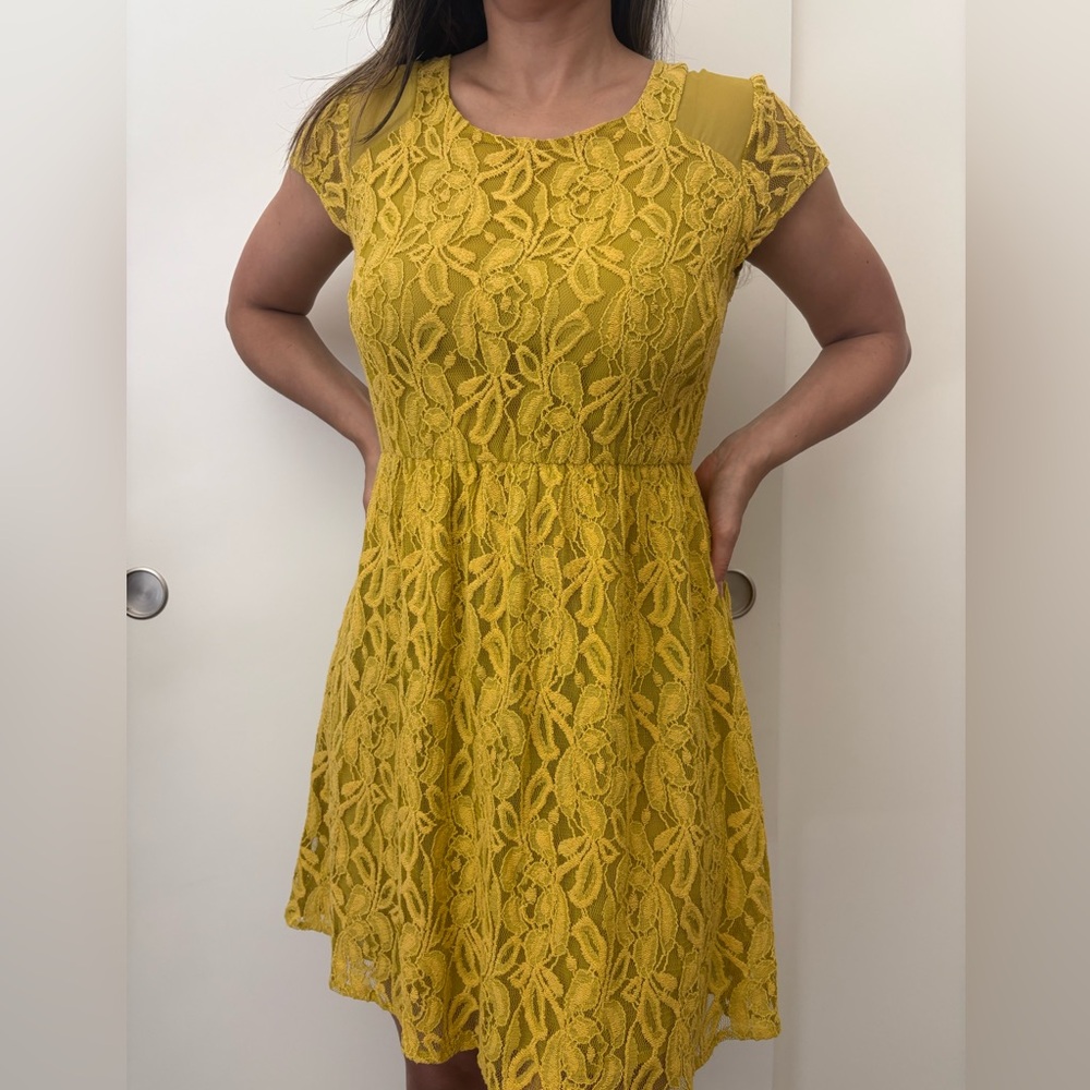 Anthropologie Lace Dress